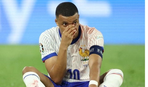 Kylian Mbappé se fractura la nariz en la Eurocopa con la selección de Francia