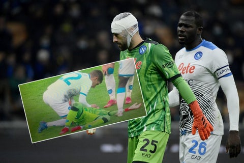 David Ospina, Serie A