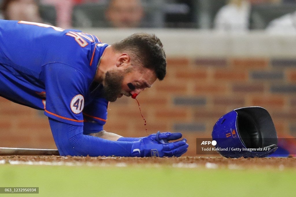 Kevin Pillar, beisbolista golpeado con la bola
