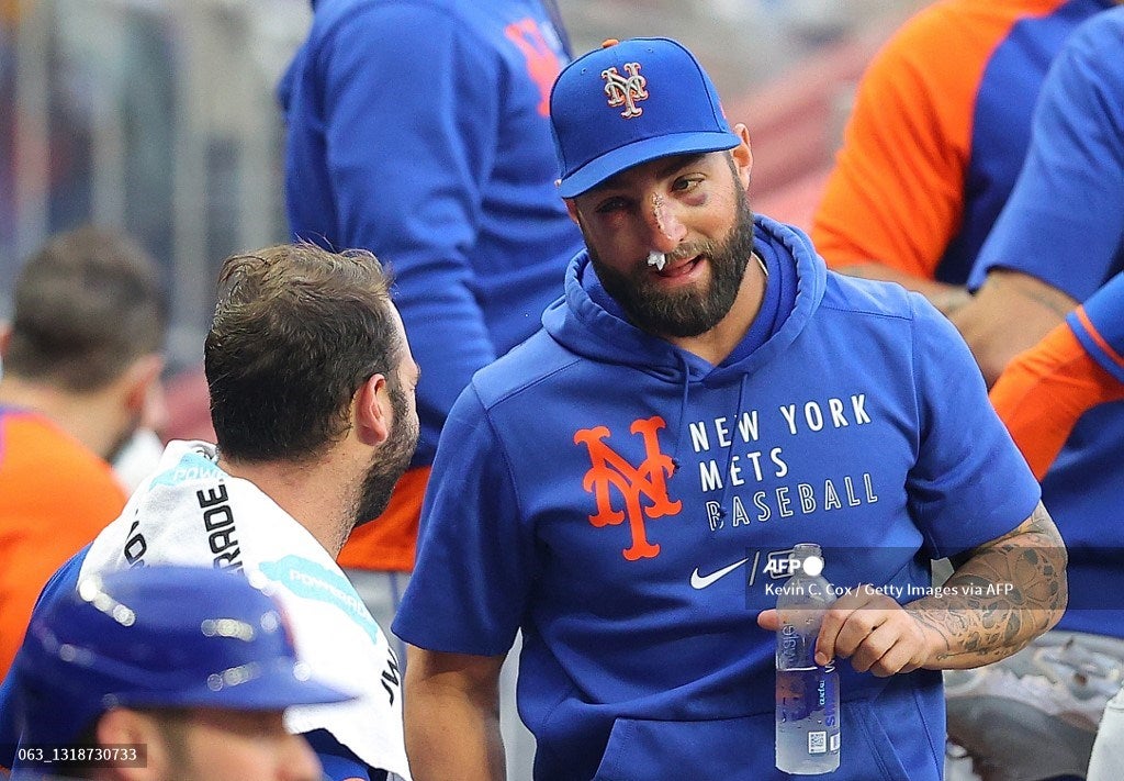 Kevin Pillar, beisbolista golpeado con la bola