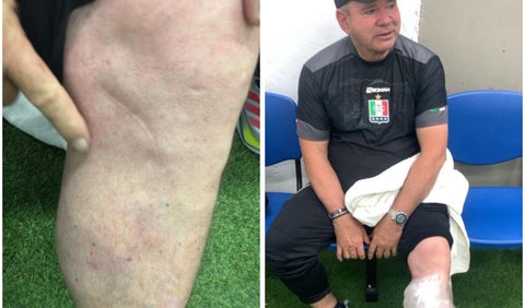 Arriero Herrera herido por hinchas de Unión Magdalena en el duelo ante Once Caldas