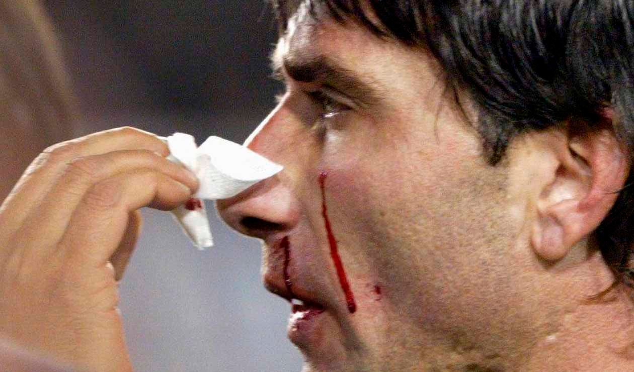 Roberto Abbondanzieri sufrió un golpe de Marcelo Gallardo -semifinal Libertadores 2004