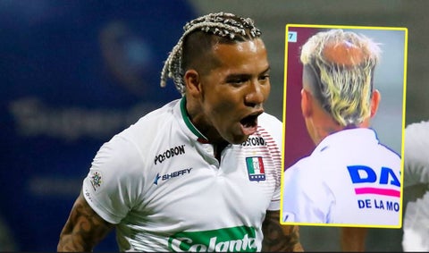 Dayro Moreno y su problema de alopecia