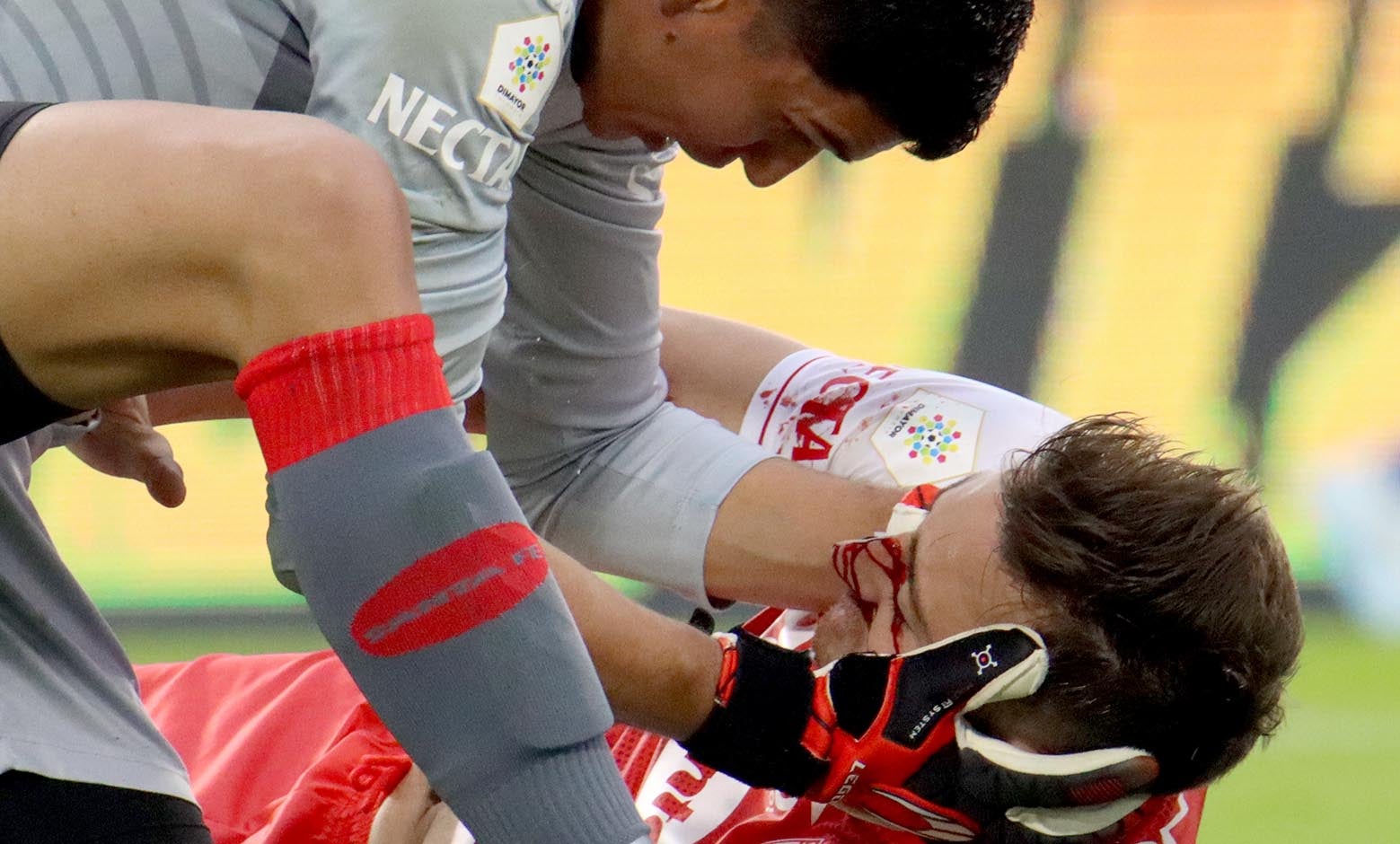 Golpe de José Aja en el clásico Millonarios vs Santa Fe