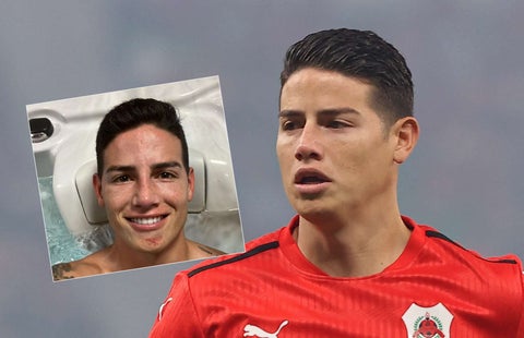 James Rodríguez, Al Rayyan, heridas
