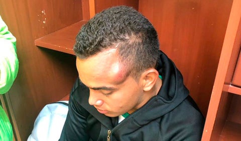 Jesus González tras golpe con Andrés Román