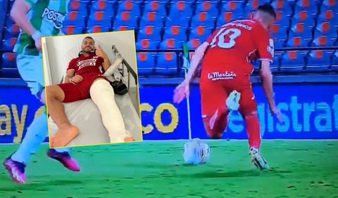 Lesión de Iago Falque, América de Cali