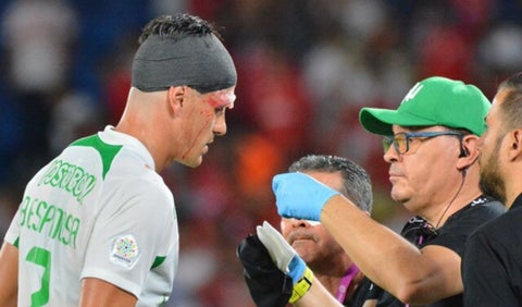 Nacional suma problemas: confirman tiempo de baja de Bernardo Espinosa