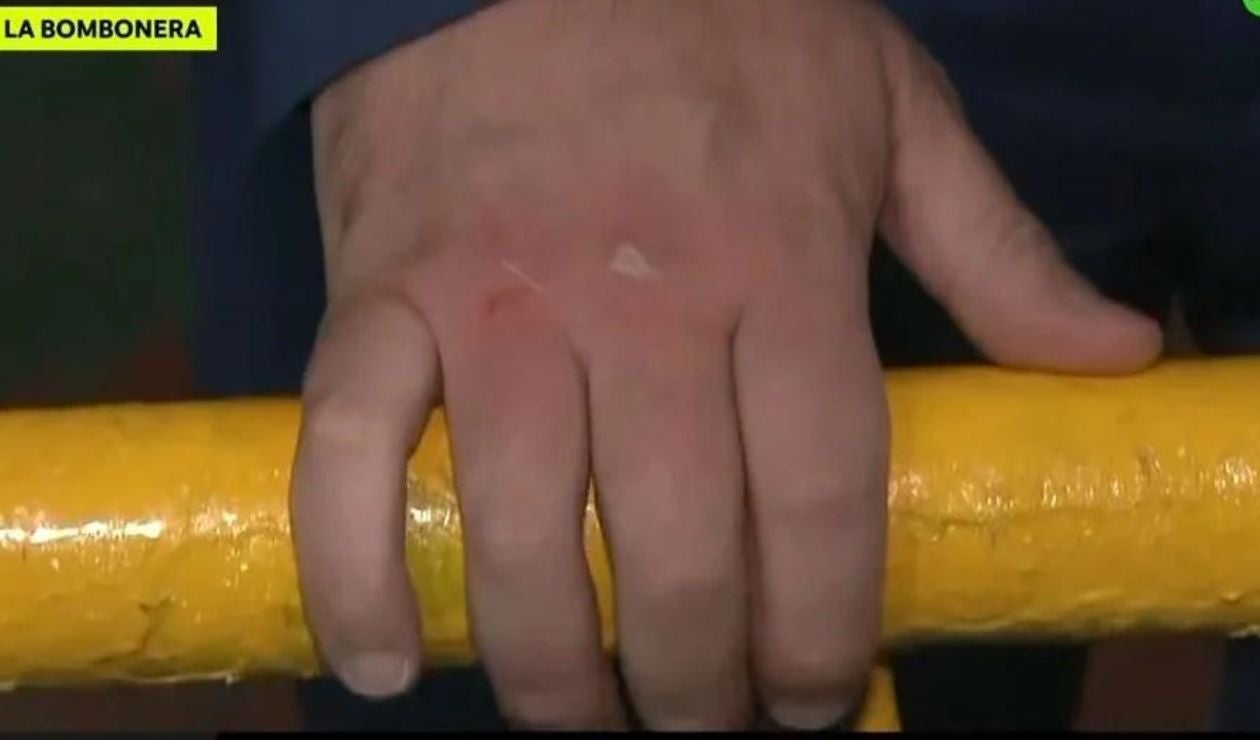 Nudillos de Ignacio Alonso