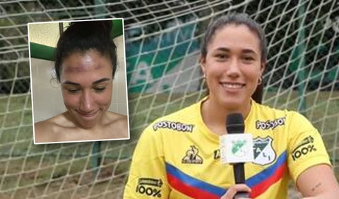 vanessa Córdoba, golpe en la cara