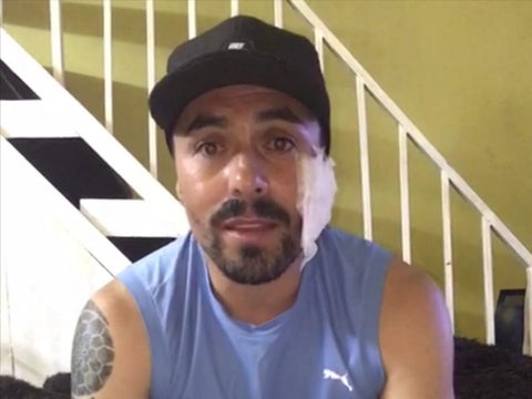 Exfutbolista Vladimir Marín pide ayuda tras fuerte accidente