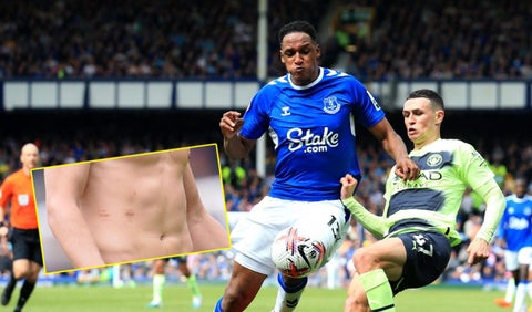 Yerry Mina, Everton